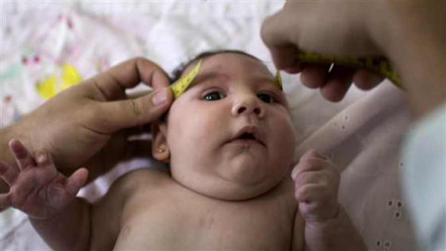 Babies who are born to mothers with the Zika Virus are at a high risk for having microcephaly. 
